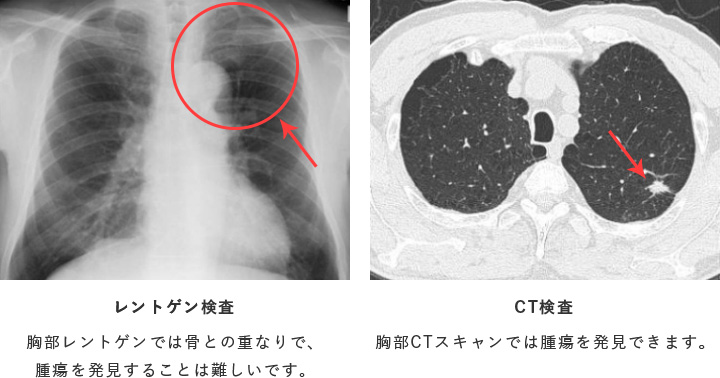 値段 レントゲン 治療費の概算（診療時間内） «